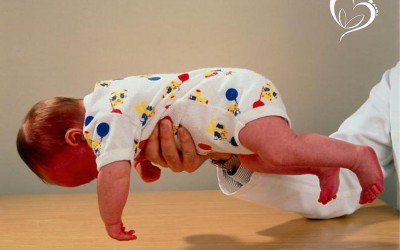 Saiba se seu bebê é hipotônico