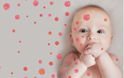 O pé do bebê e a Epidermolise Bolhosa