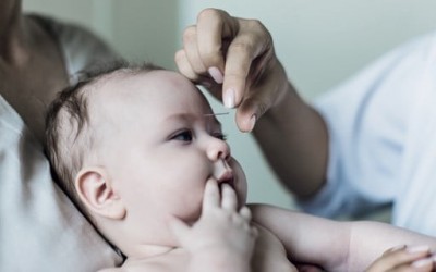 5 situações em que acupuntura em bebês pode ajudar