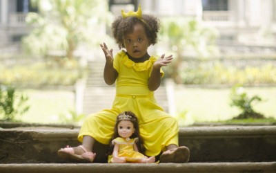 Síndrome de Down: como ela afeta os pezinhos?