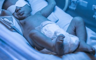 Icterícia neonatal: quando se preocupar com o amarelão?