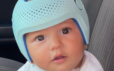 Assimetria craniana posicional, entenda!